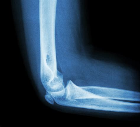 Criminal History Record Check - ND Medical Imaging & Radiation Therapy Board