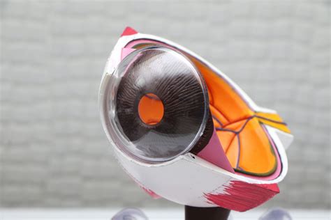 What is a Posterior Vitreous Detachment (PVD)?