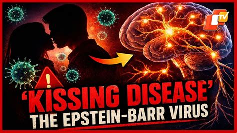 'Kissing Disease' Victims At Risk Of Developing Multiple Sclerosis!