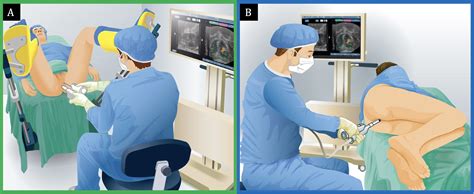 SciELO Brasil - Transperineal versus Transrectal MRI/TRUS fusion-guided prostate biopsy in a ...