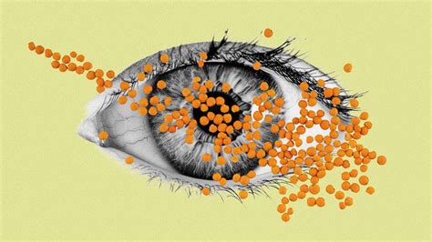 Why I’m walking round with a lentil in my eye - The New World