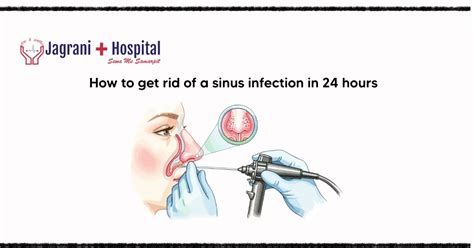 How to Get Rid of a Sinus Infection in 24 Hours | Causes, Relief & Care