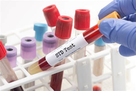 How Often Should Sexually Active Adults Get Tested for STDs? - DTAP Medical Clinic | GP STD HIV ...