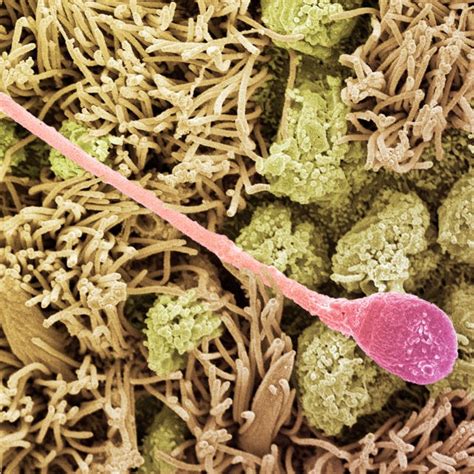 Scientists Caught Sperm Ignoring A Major Law of Physics