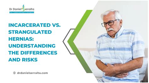 Precautions After Hernia Surgery: What You Need To Know - One For All