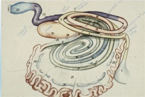 Lower bowel disease Flashcards | Quizlet