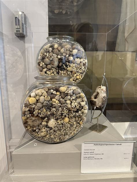 The Last Word On Nothing | Buried Treasure