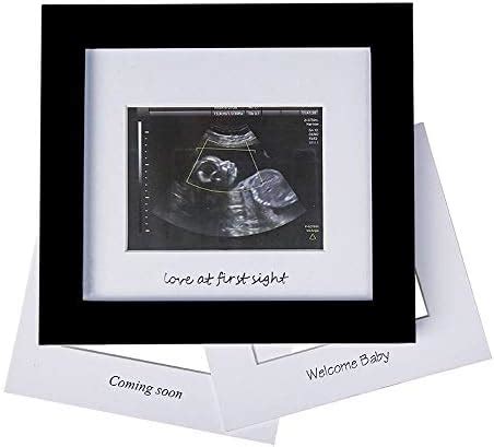 Amazon.com : IHEIPYE Baby Sonogram Photo Frame - 1st Ultrasound Picture ...