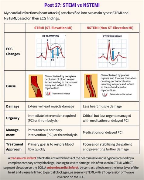 STEMI vs NSTEMI | Tejpal Parihar. CPC, CAIMC - One For All