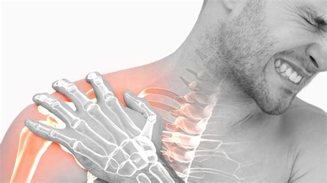 Frozen Shoulder:ऐसा लगता है जैसे जाम हो गए हैं कंधे, हाथ उठाना तक हो गया है मुश्किल? ये फ्रोजन ...