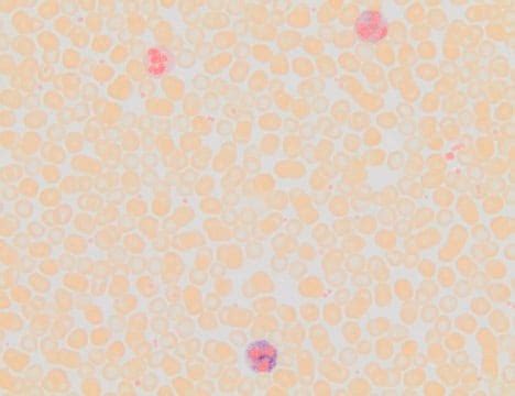 Leukocyte Alkaline Phosphatase Kit based on naphthol AS-BI and fast ...