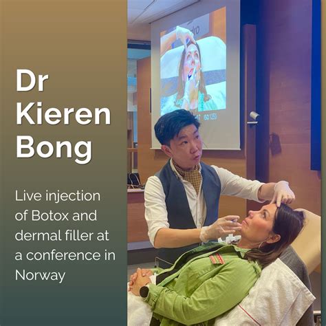 How Often Do You Have to Get Botox? ⋆ ctf.bnsf.com