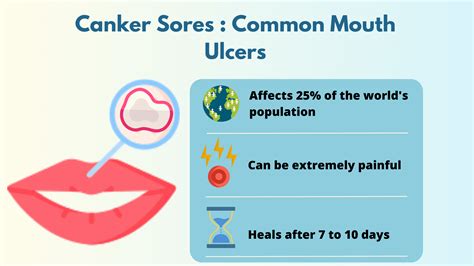 How To Prevent Canker Sores From Forming