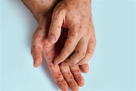 New virus strain found in UK for first time is 'precisely what experts ...