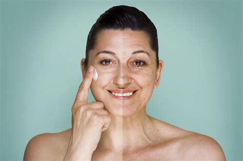 MANCHAS OJERAS | Izaskun Ruiz, farmacéutica: "El ácido tranexámico ayuda a eliminar todo tipo de ...