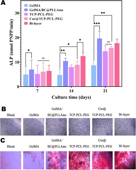 3D-printed GelMA/BC@PLLAms-Cur@TCP-PCL-PEG bilayer scaffold for osteochondral repair - RSC ...