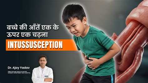 Understanding Intussusception | बच्चों की आंत एक के ऊपर एक चढ़ना ...