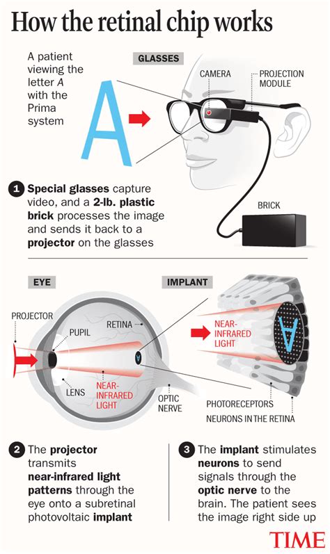 Computer Chips in Our Bodies Could Be the Future of Medicine | TIME