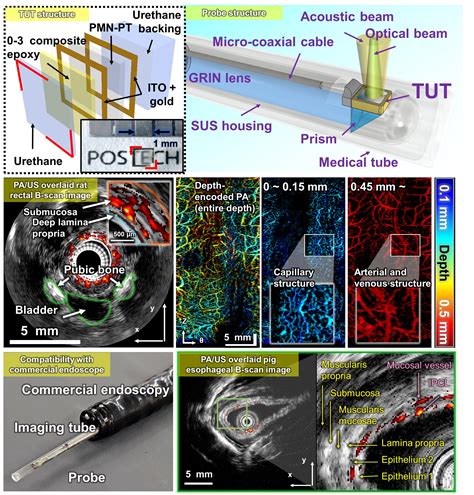 Enhanced dual-mode imaging: New transducer delivers ultrasound and photoacoustic imaging ...