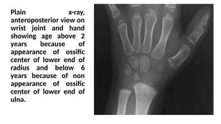 identifcation of bones by x-ray - Copy.pptx