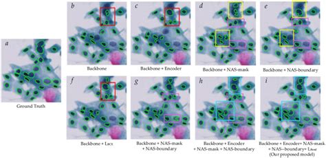 BLoss-DDNet: bending loss and dual-task decoding network for ...