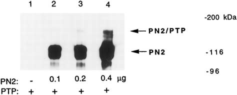 The Kunitz Protease Inhibitor Form of the Amyloid Precursor Protein ...