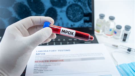 Mpox: What you need to know about risk, symptoms and more