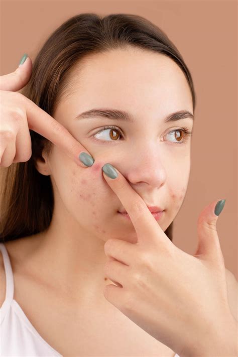 From forehead breakouts to chin pimples: Dermatologist explains what ...