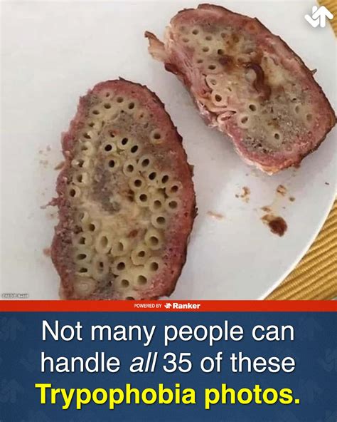 Ranker - People Share Their Unexpected Trypophobia Moments 👇 | Facebook