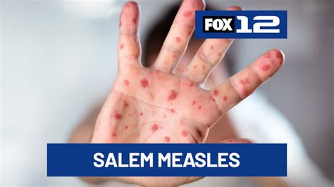 ‘People are on edge’: Man still on the loose after robbing five Plaid ...