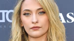Rare Eye Features Most People Don't Have