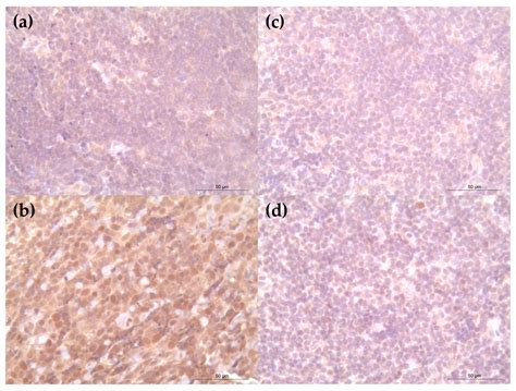 Solitary Subcutaneous Nodular Lymphoid Lesions in Dogs: Histopathologic ...