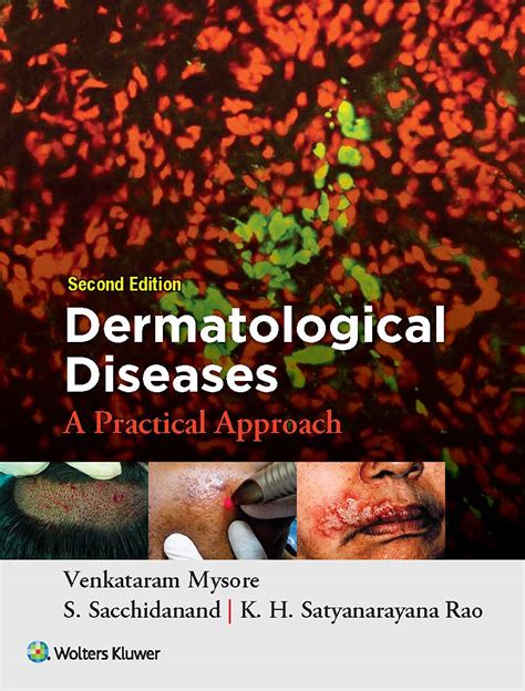 Dermatological Diseases: A Practical Approach, 2ed : Venkataram Mysore ...