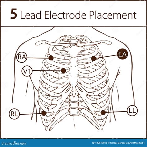 Ecg Lead Placement Cartoon Vector | CartoonDealer.com #61192935
