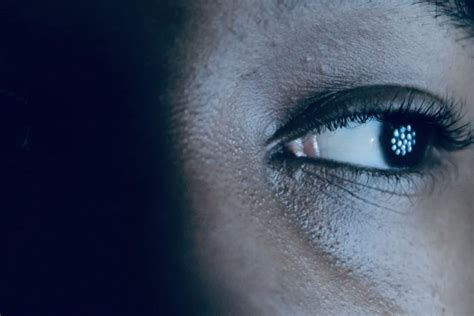 What Is Visual Snow Syndrome? Causes, Symptoms & Treatment