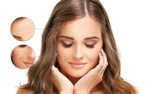 10 ब्यूटी टिप्स: आंवला से दूर करें चेहरे के दाग-धब्बे, हेयरफॉल की भी ...