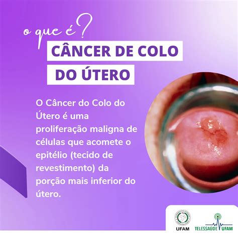 Março Lilás é o mês de prevenção ao câncer de colo de útero