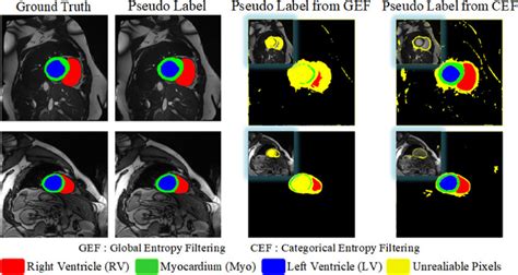 Image result for Entropy Filter Images