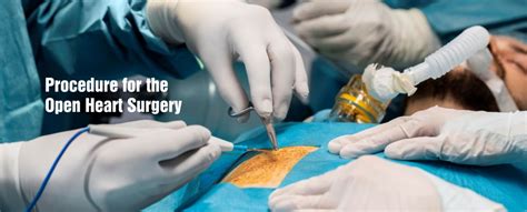 Open-Heart Surgery: Procedure, Risks & Recovery