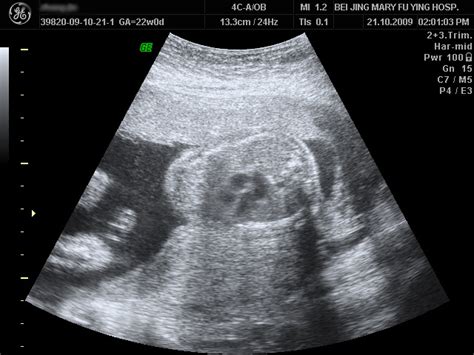 怀孕一个月的胎儿_怀孕13周胎儿图_怀孕4个月胎儿图_怀孕53天胎儿的样子 - 黑马素材网