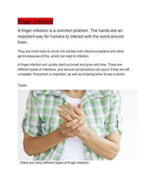 Clinical approach to fever - FEVER(Pyrexia) Is an elevation of body ...