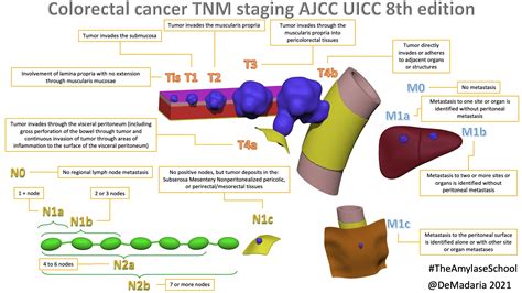 Rectal Cancer Staging