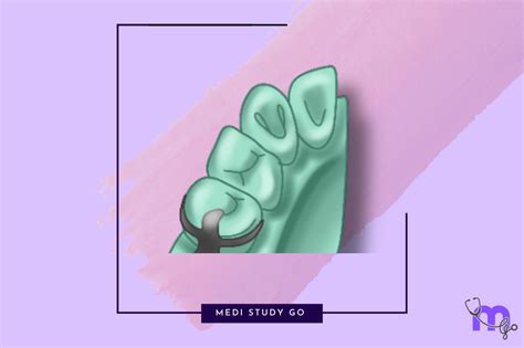 How to Prepare Rest Seats: Step-by-Step Guide – Medi Study Go