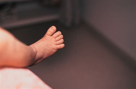 Babies Dying as Congenital Syphilis Continues U.S. Surge