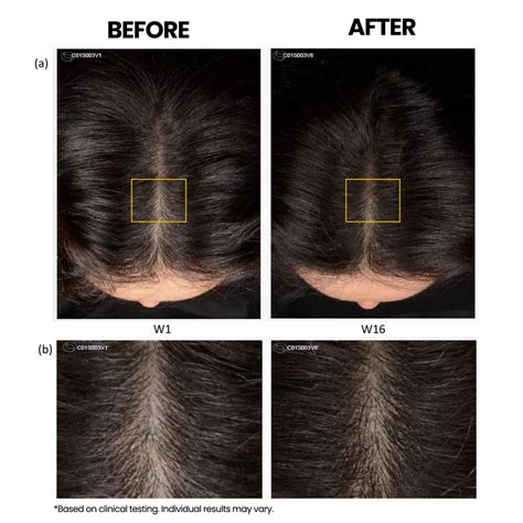 Rosemary Anti-Hair Fall Shampoo with Rosemary & Methi Dana – Sacred Herbs