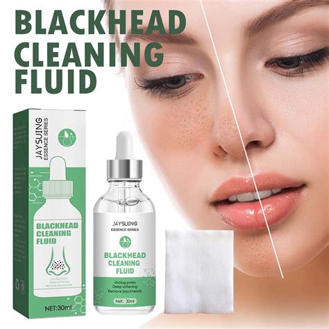 Black Head Removal Cream