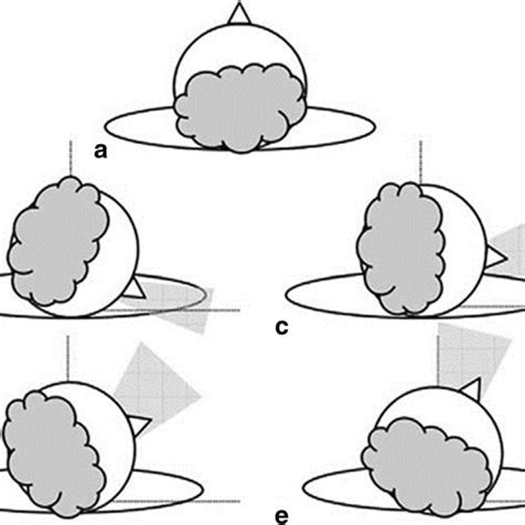 Image result for Cervical Rotation Goniometry