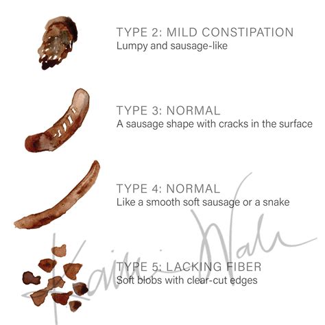 Colon Cancer Stool Shape