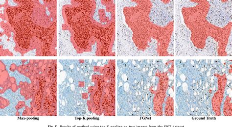 Image result for Image Segmentation Graph Convolution Network