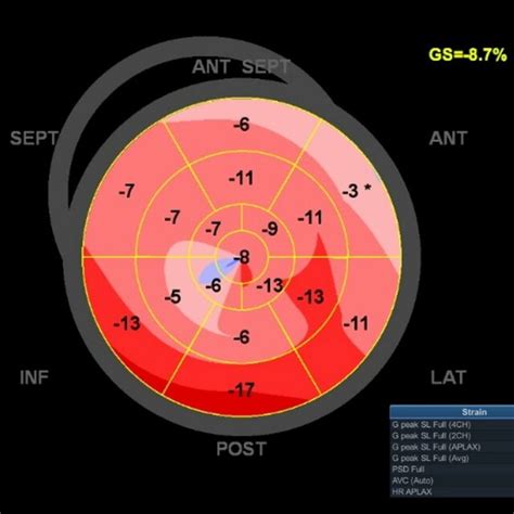 Image result for GLS EViews